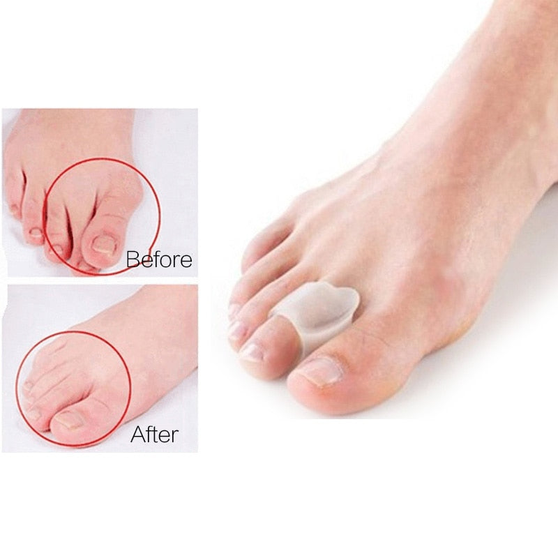 Silicone Toes Separator